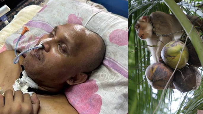 猴子樹上跌椰子 電單車男爆頭癱瘓 昏迷4個月不醒