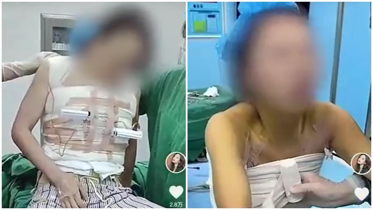 河南女隆胸被偷拍網上任睇，醫院一個理由拒道歉賠償。(微博)