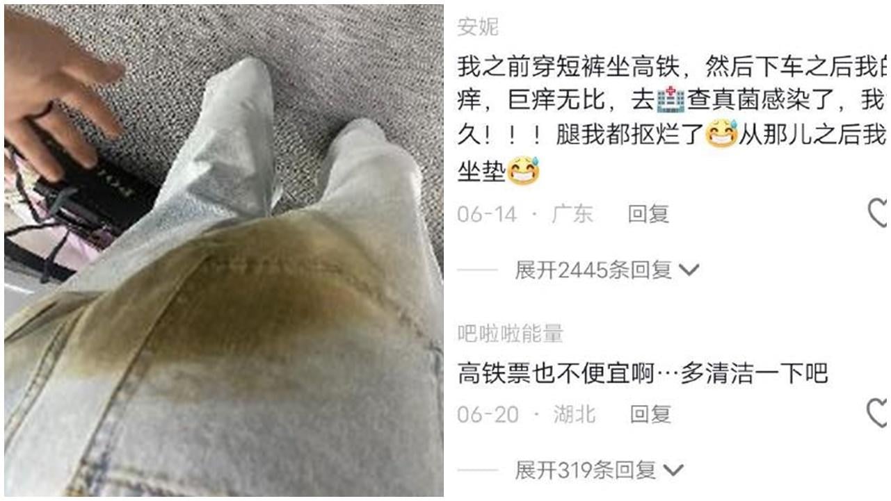 著短褲坐高鐵女感染真菌勁痕，官方：每隔180日換洗一次。(微博)
