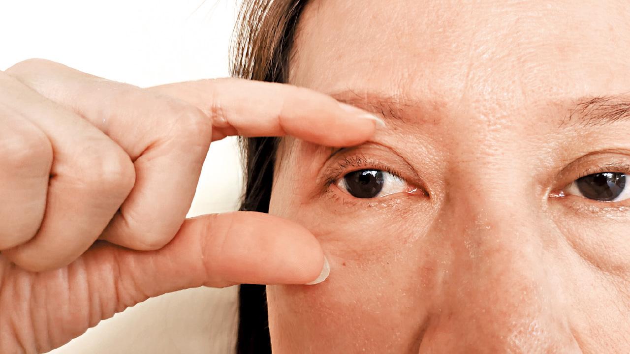 控好血糖 預防糖尿上眼