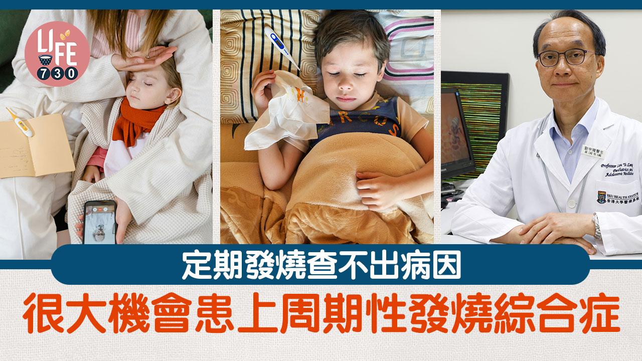 定期發燒查不出病因 很大機會患上周期性發燒綜合症