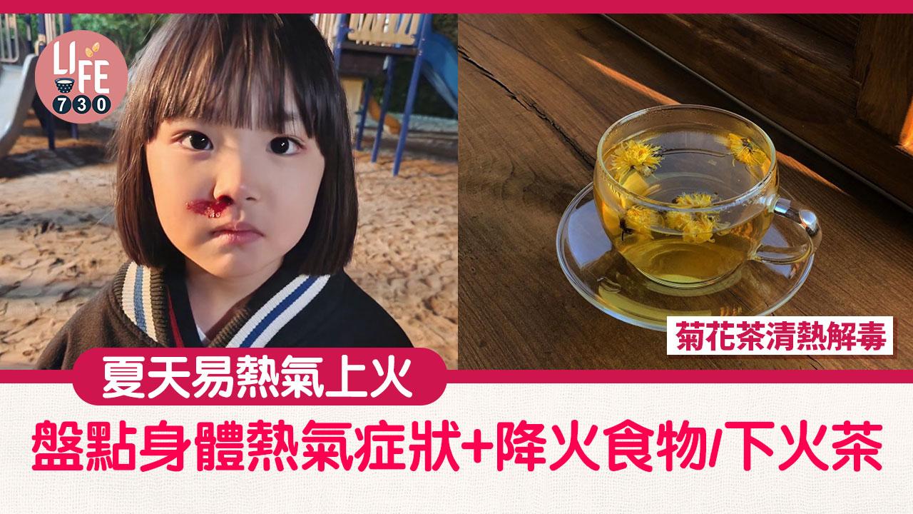 夏日養生｜夏天易熱氣上火！盤點身體熱氣症狀+降火食物/下火茶