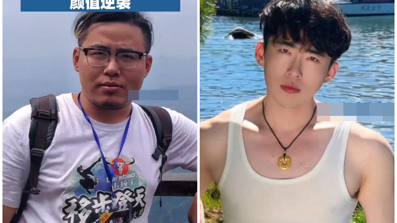 山東男5個月喪減110磅，五官逆襲震驚網民。(微博)