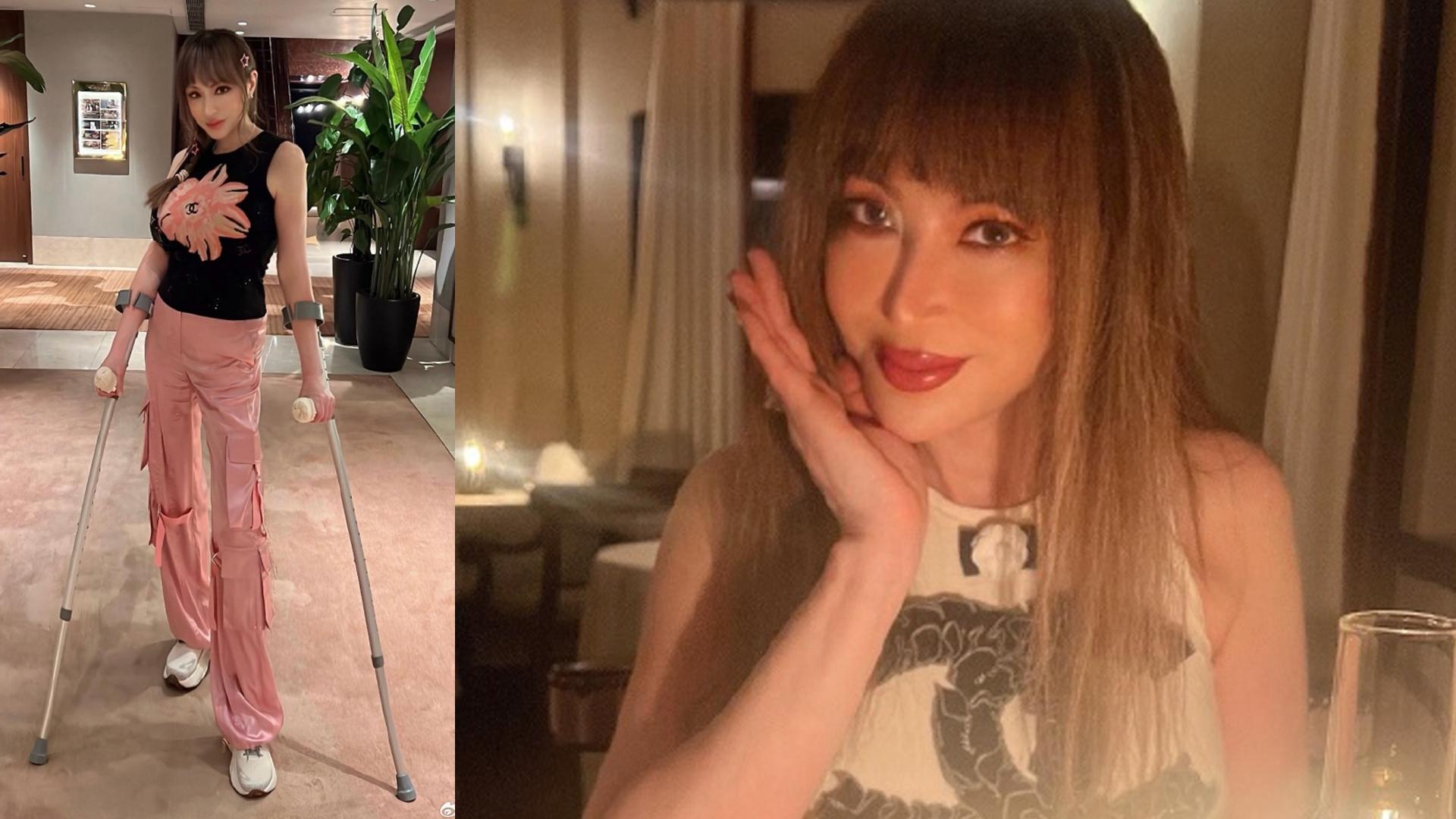 薛芷倫3個月前盆骨骨裂 出入要靠枴杖已康復8成