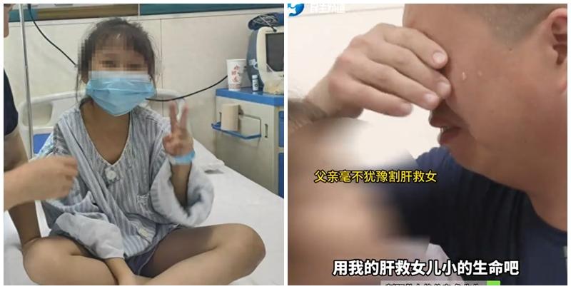 詹先生為了救愛女努力減肥，3個月勤運動節食戒減去17公斤，最終如願以償捐肝，手術非常成功。(影片截圖)