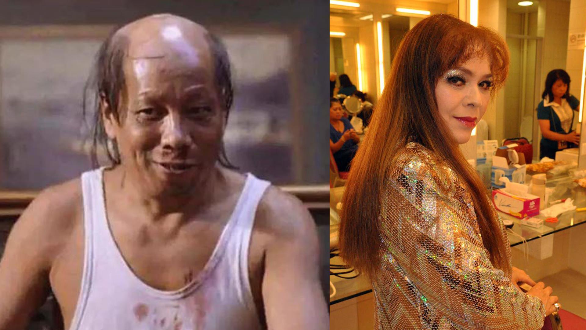 「火雲邪神」梁小龍混血前妻黎愛蓮離世 遭鏹水毀容植皮磨皮廿次