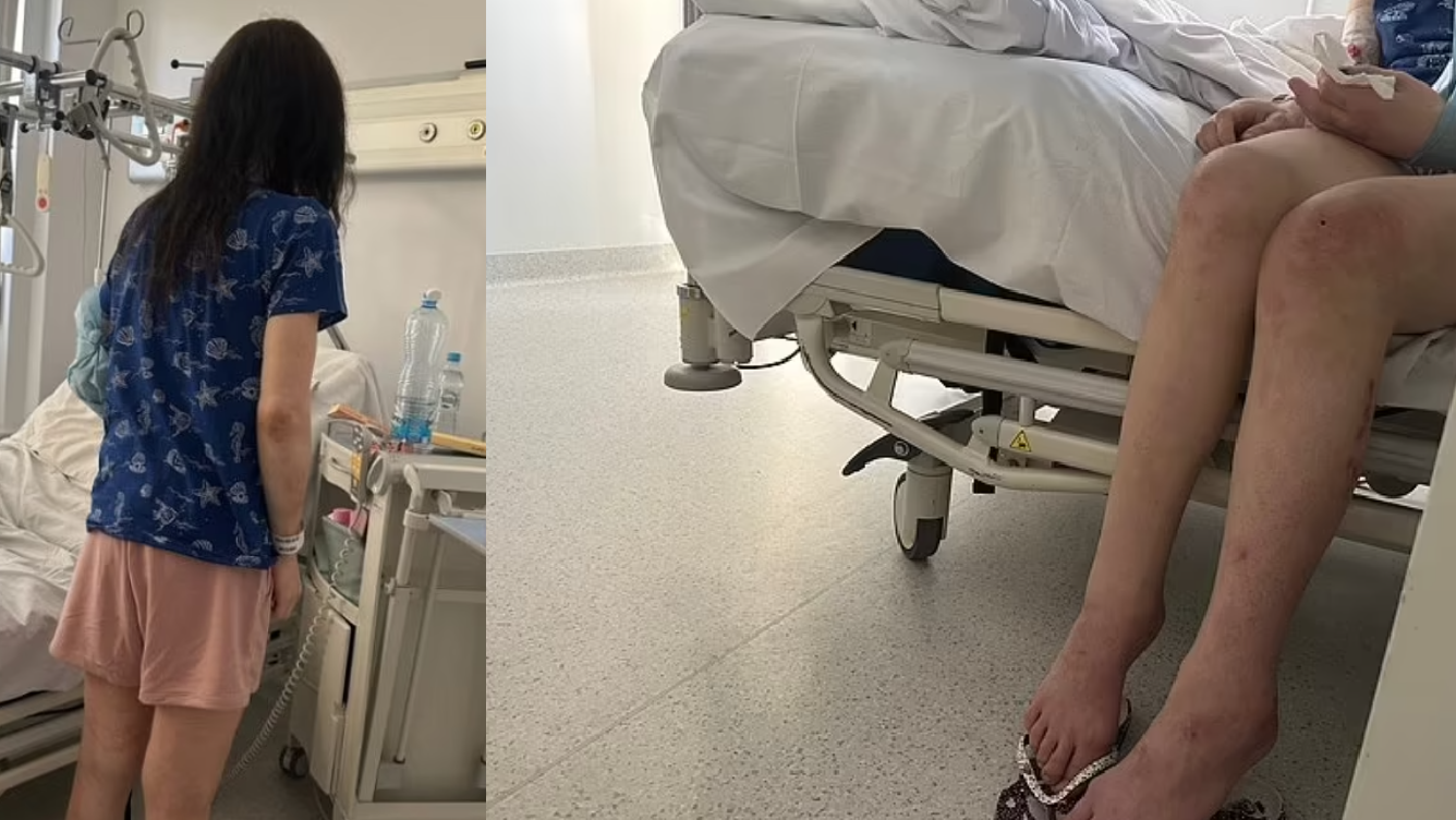 30歲女被禁錮4年淪「實驗性奴」遭拔牙割唇嘴部如一個洞 貌似50歲