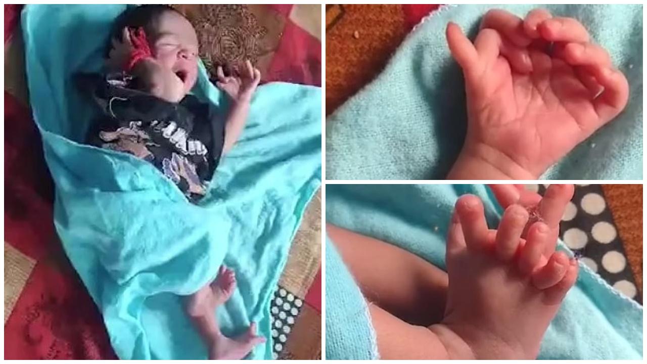 印度女嬰天生14手指12腳趾，家人村民喜獲「女神化身」。(X)