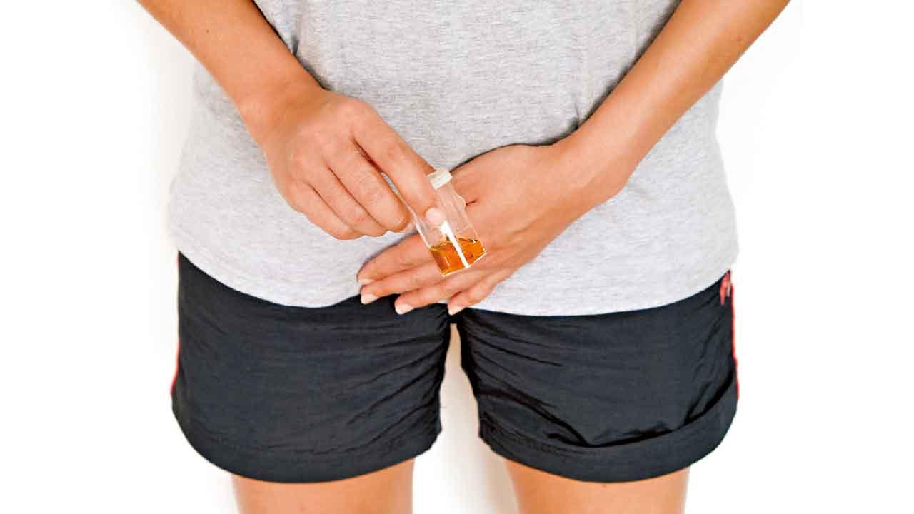 無痛血尿 小心膀胱癌