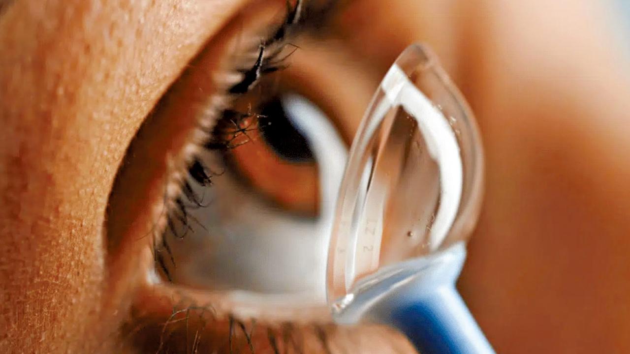 被忽略的眼睛(中)