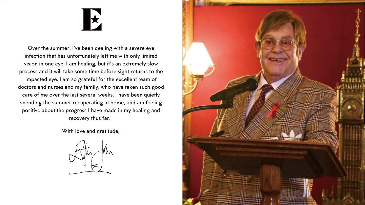 Elton John眼部被細菌感染 發文稱一隻眼睛視力受損