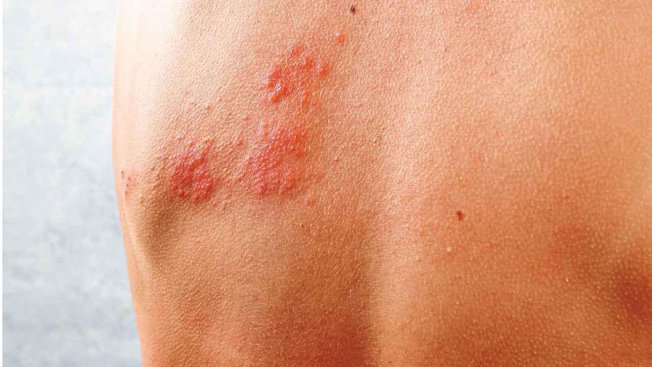 秋天生蛇 雞骨草赤豆薏苡湯