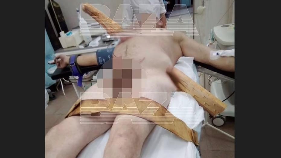 從醫院發布的照片可見，尼古拉躺在急救病床上，巨型木板貫穿其上半身。(互聯網)