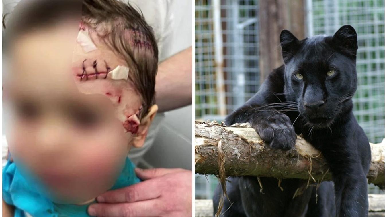 愚父說服馬戲班放黑豹出籠合照，害3歲兒慘被撕咬毀容。(X)