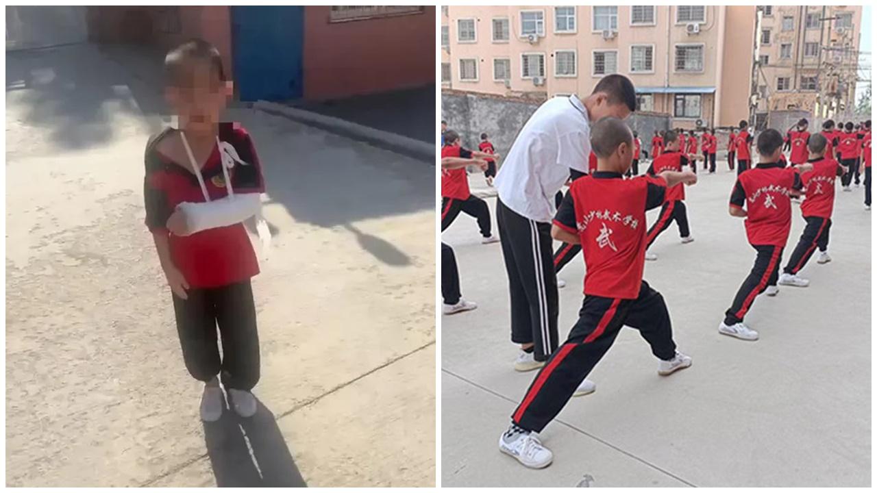 送6歲兒上少林武校盼「文武雙全」，2個月被助教打成多處骨折。(微博)