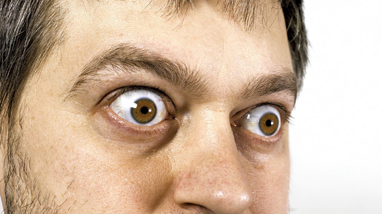 重影 眼腫 眼凸 或患甲狀腺眼病