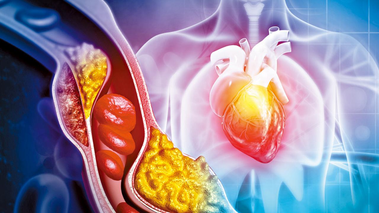 膽固醇藥一食就唔停得？