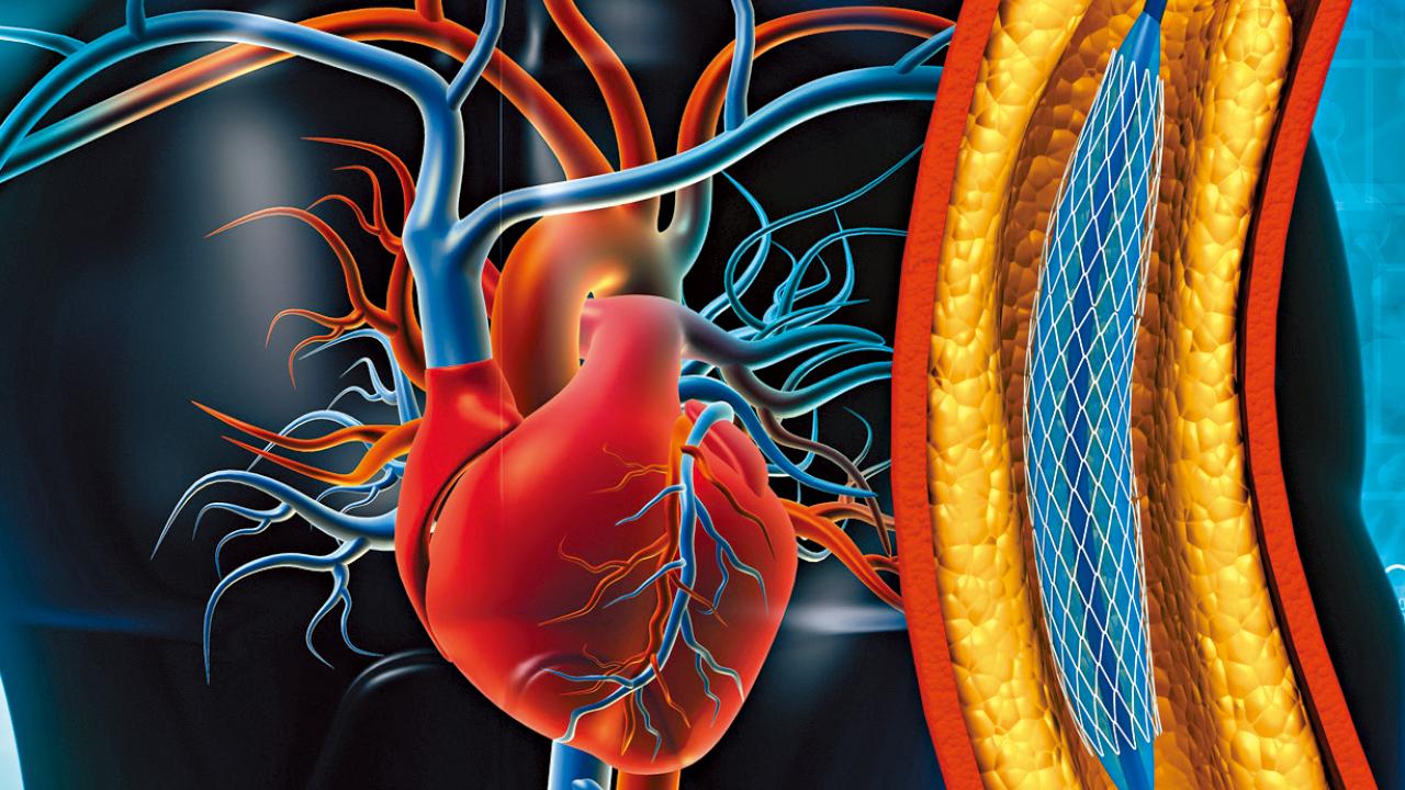 3大原因需要二次通波仔