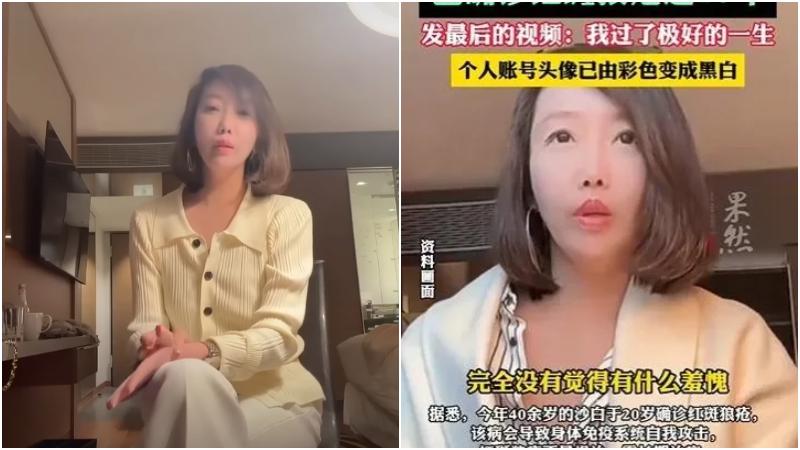 上海女赴瑞士安樂死　患紅斑狼瘡廿年　痛起來生不如死