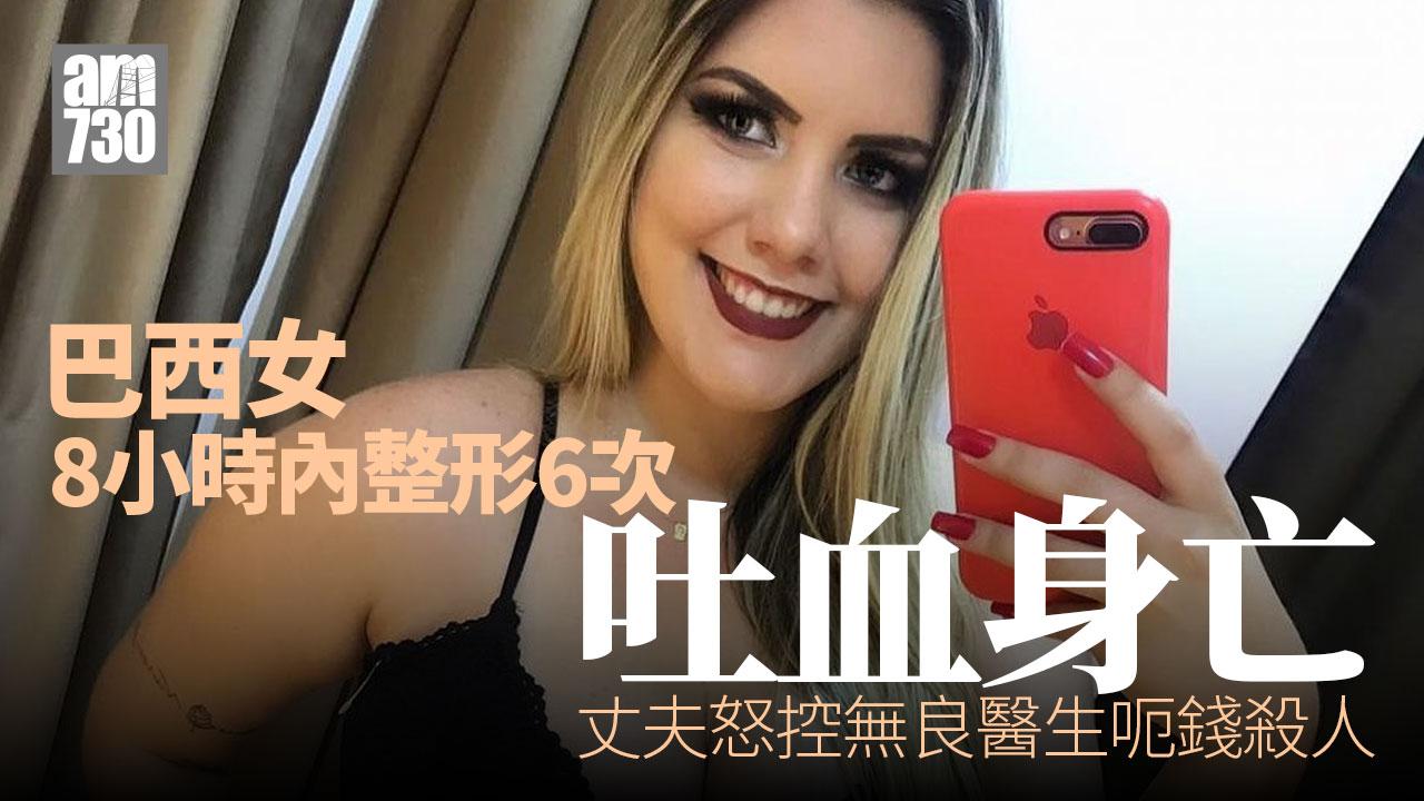巴西女8小時接受6次整容手術