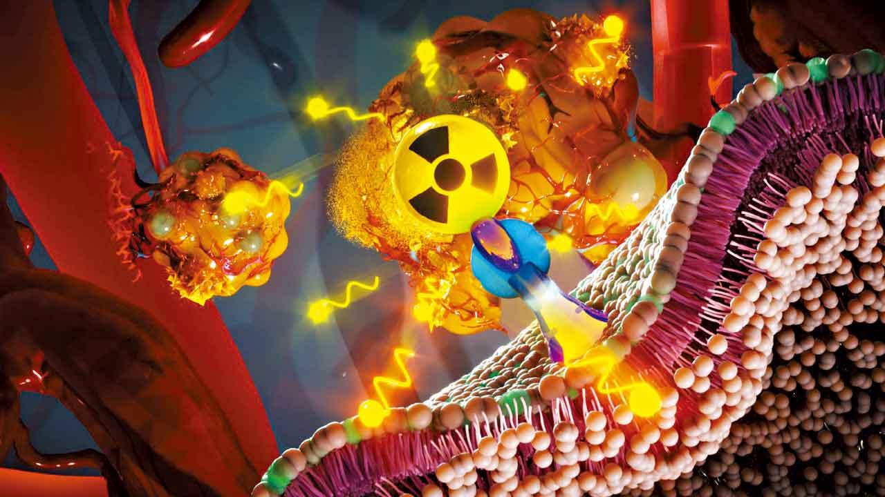 首引入標靶放射治療 暫緩前列腺癌惡化