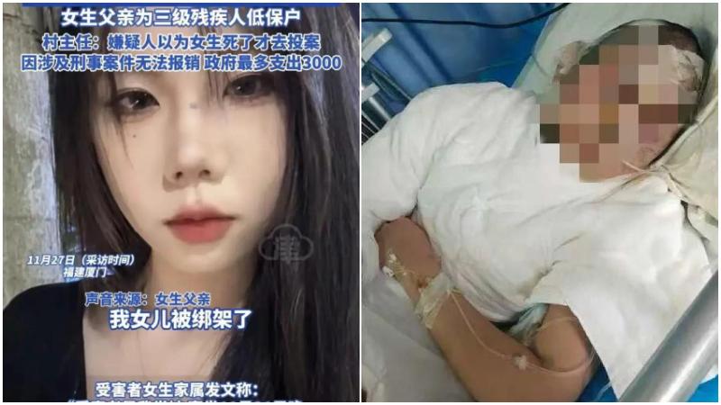 福建少女遭前男友綁架　反覆暴打潑滾水毁容