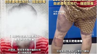 四川男陷緬甸詐騙集團生不如死　電擊虐打強迫吸毒跑數