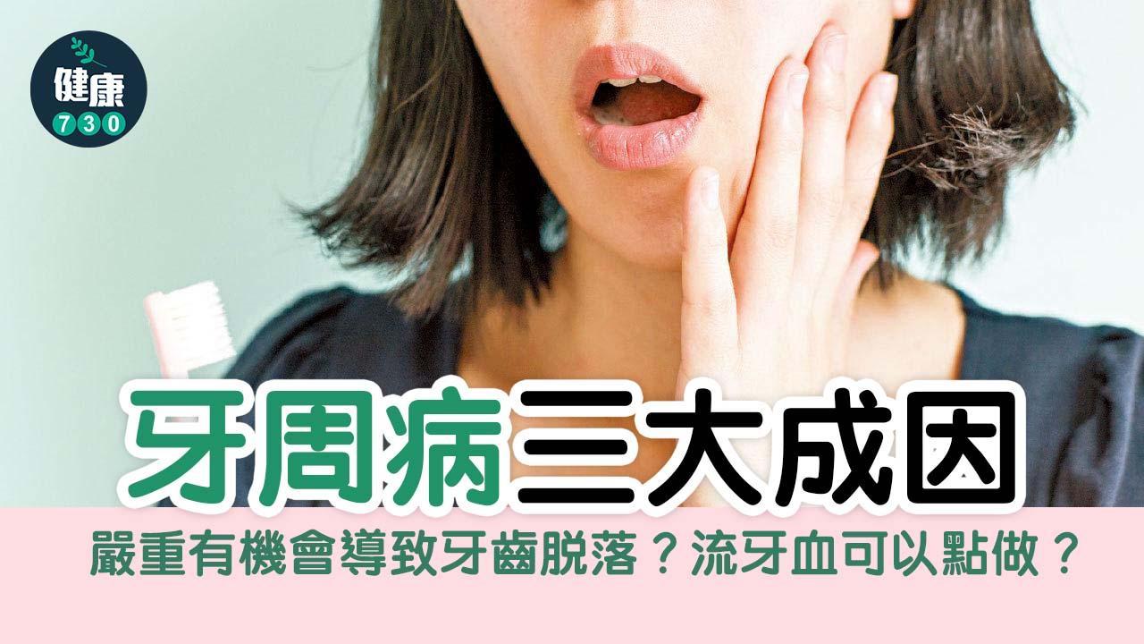 牙周病｜情況嚴重有機會導致牙齒脫落？流牙血可以點做？（am730製圖）