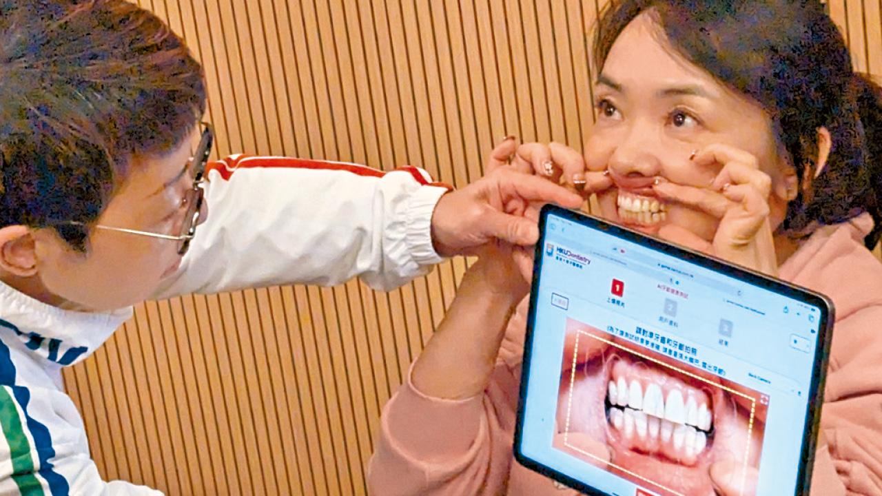 港大牙醫學院研AI系統 數秒測牙肉牙齦健康