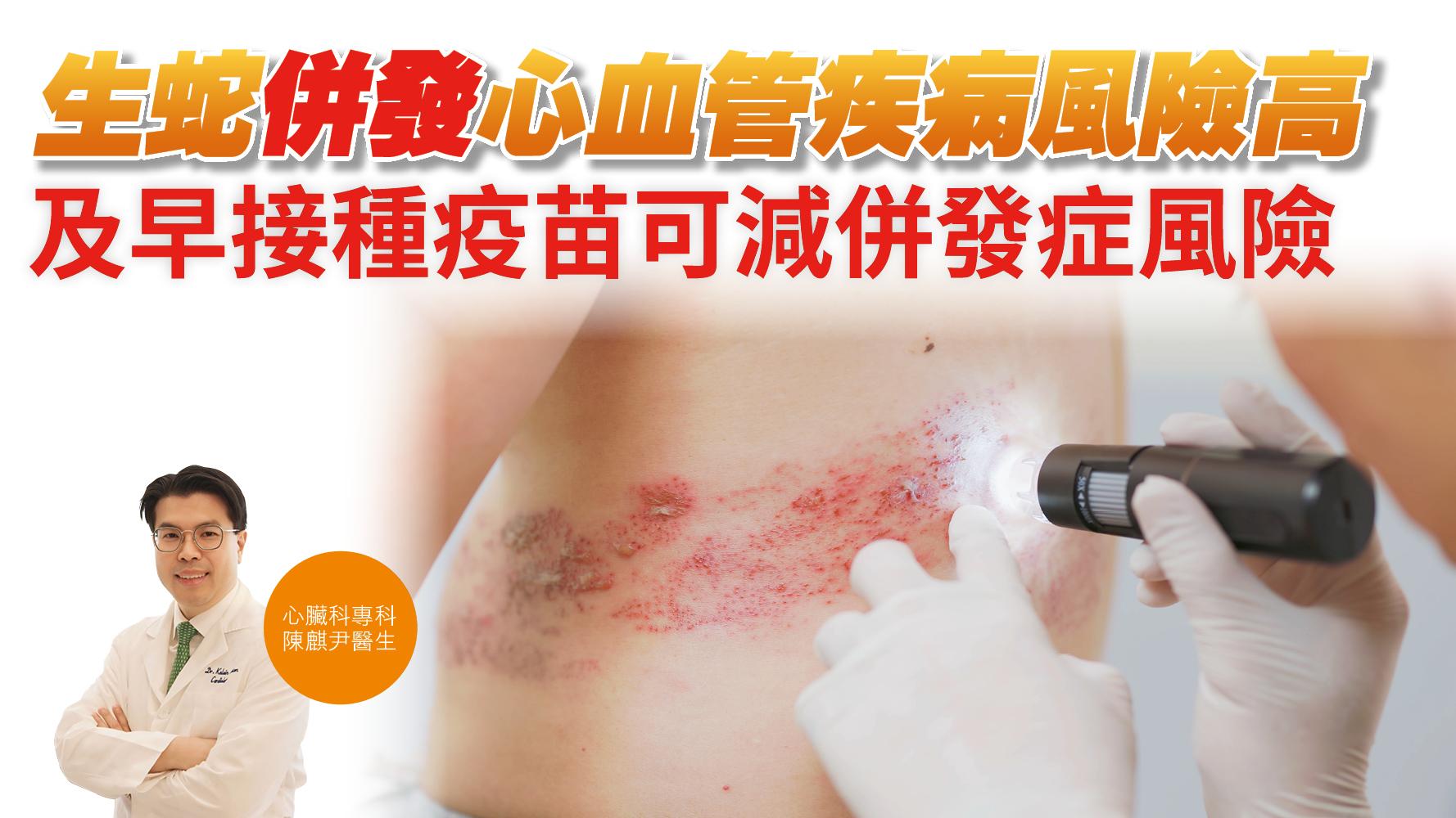 健康解碼｜生蛇併發心血管疾病風險高 及早接種疫苗可減併發症風險