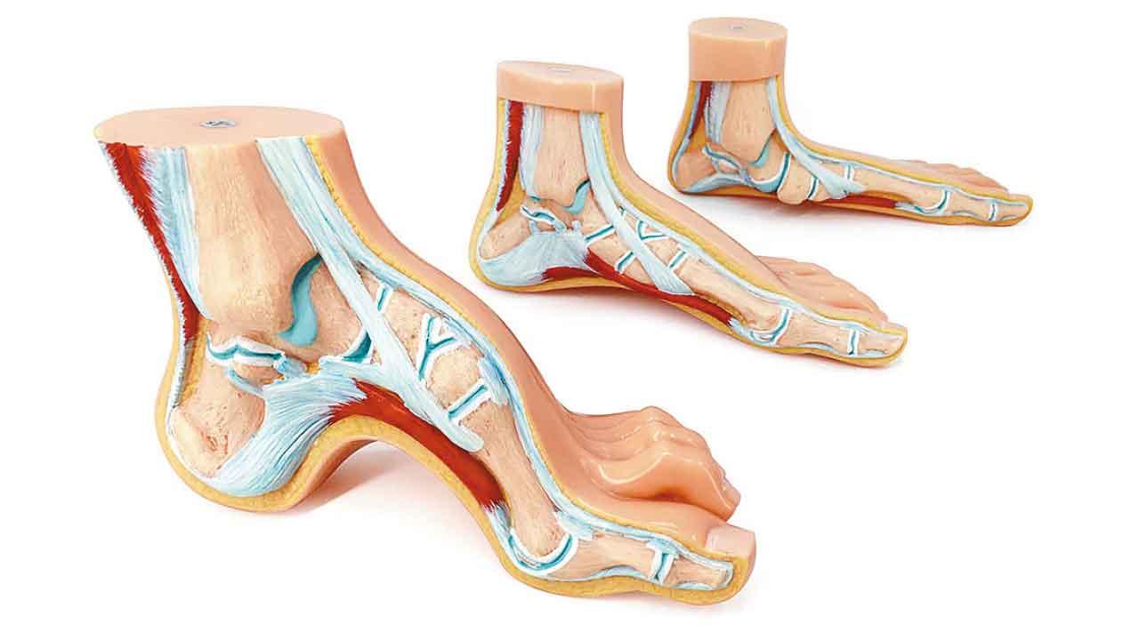 扁平足及高弓足