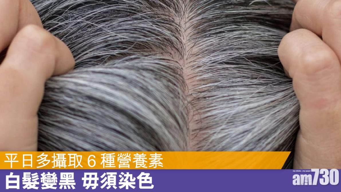 白髮變黑食療｜全靠維他命B雜、鋅、鐵等6種營養素（am730製圖）