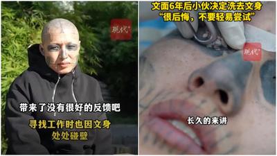 遼寧紋身迷紋出「熊貓眼」　影響求職及日常生活極後悔