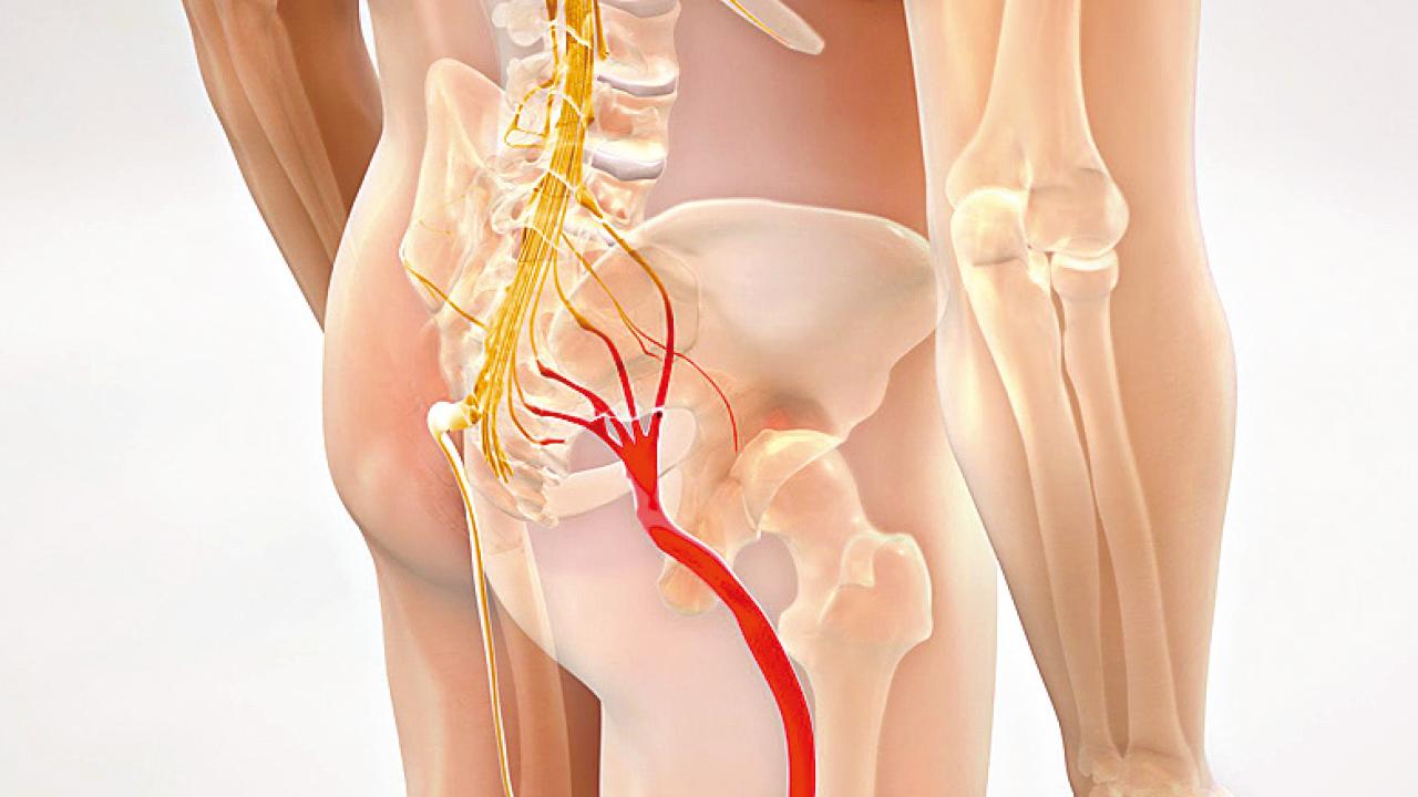 坐骨神經在哪裡？