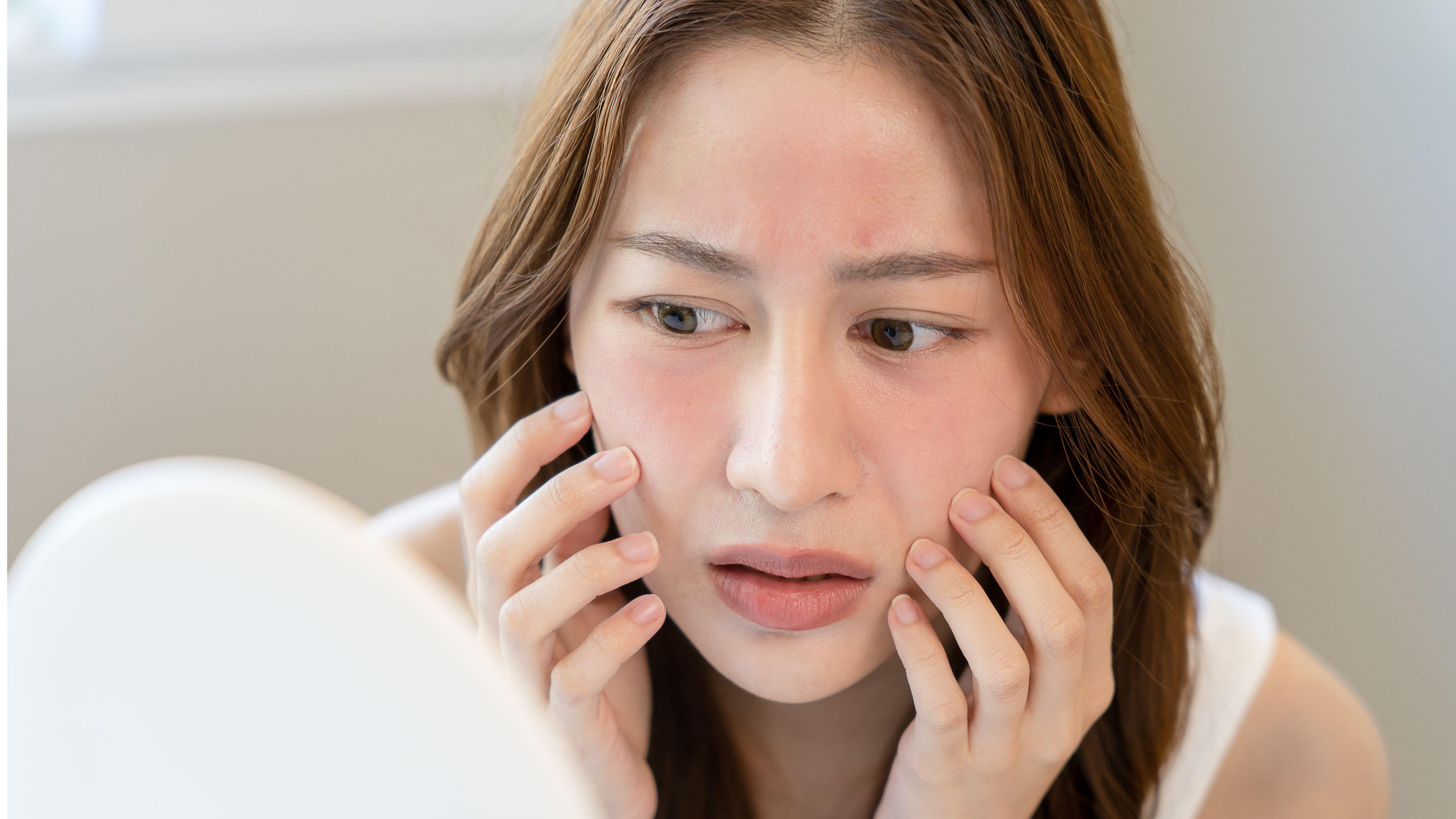 皮膚敏感 皮膚紅癢 皮膚刺痛 中醫