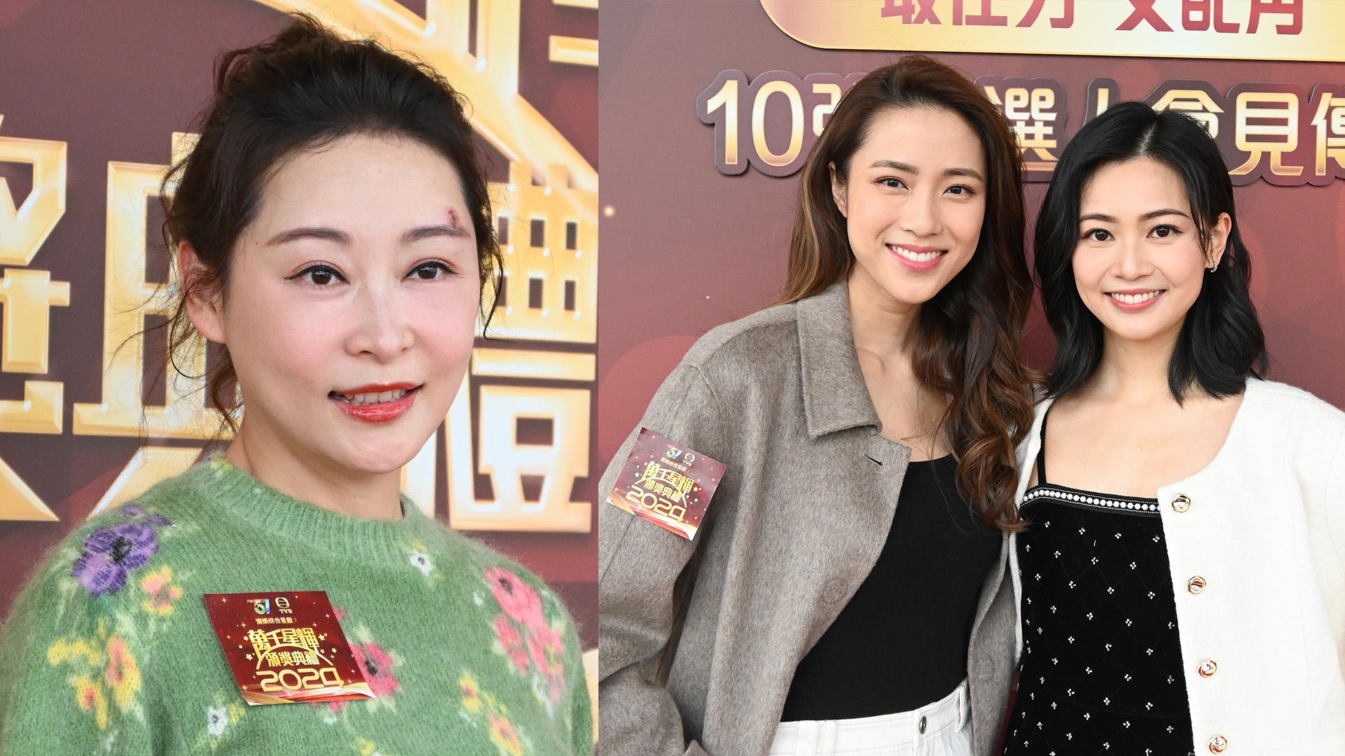 楊卓娜內地拍劇被蟲咬到破相 郭柏妍開心與家人過新年