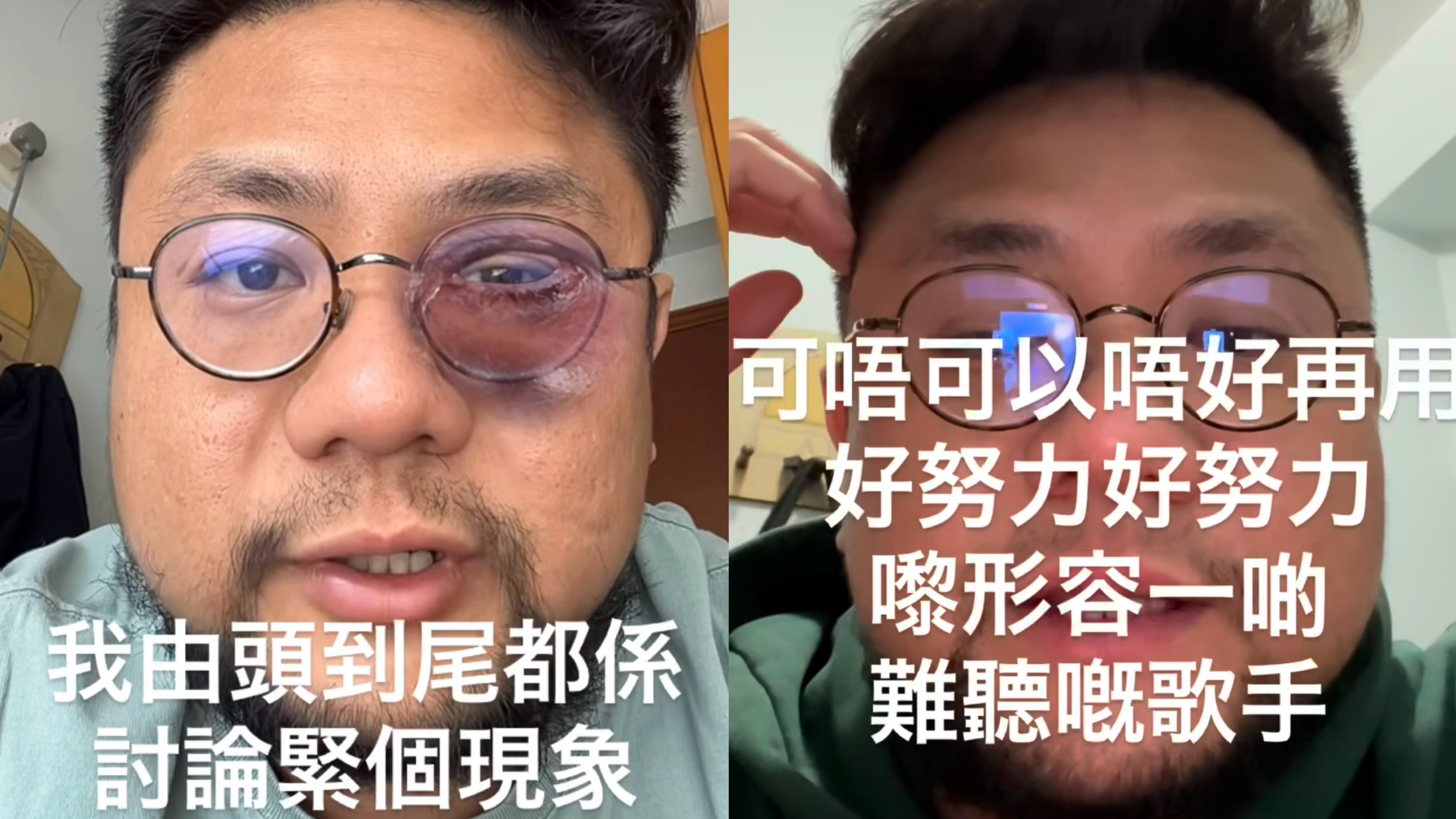 網紅拍片鬧爆粉絲努力論 直斥：唔好再用「好努力」形容難聽歌手