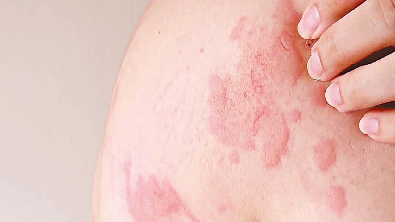 衞生防護中心呼籲市民接種疫苗。