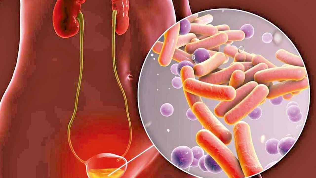 尿道炎和膀胱炎