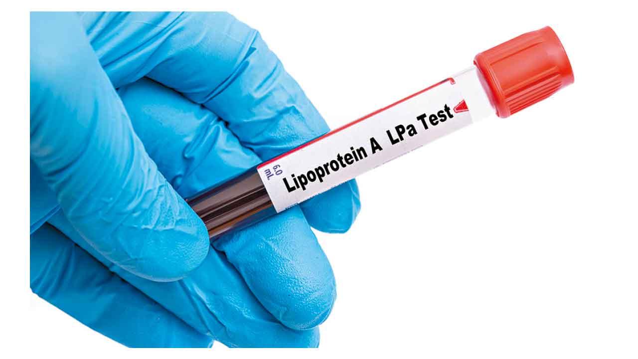 膽固醇之謎：ApoB以外另一重要檢測