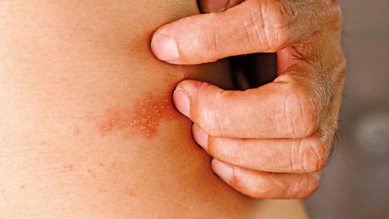 慢性疾病削弱免疫力 增生蛇危機