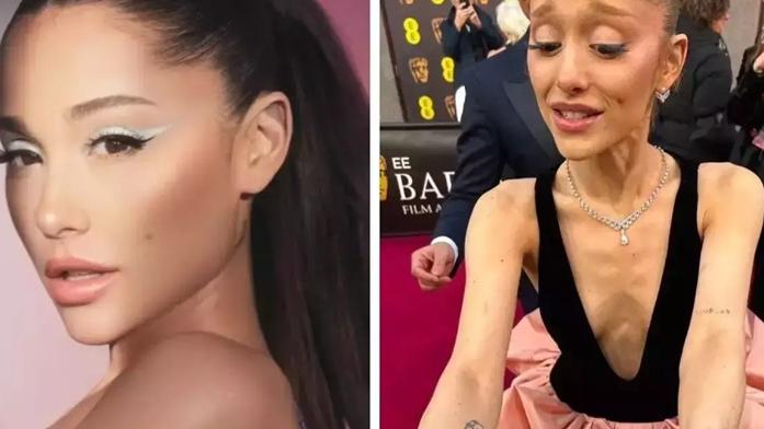Ariana Grande被壓力吸乾體重 抗鬱藥過量引發反效果