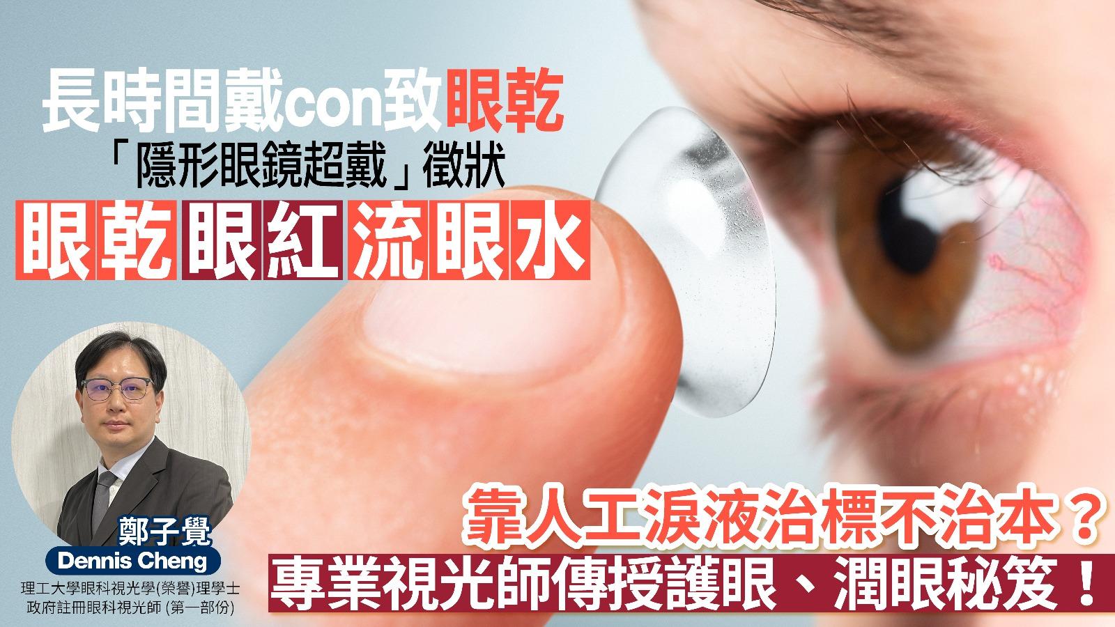 長時間戴con易眼乾眼紅 頻繁使用人工淚液仍治標不治本 專業註冊眼科視光師傳授護眼秘笈