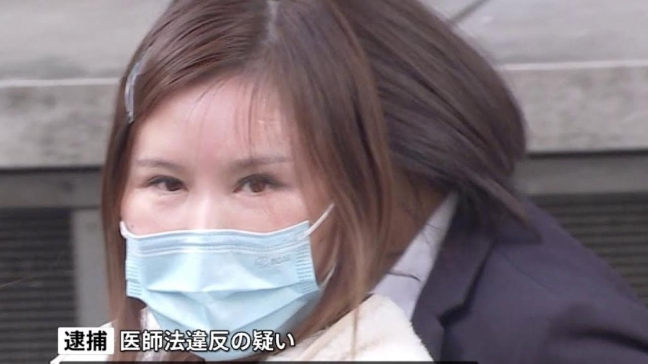 女子赴日本割雙眼皮險毁容　3中國人士無牌開刀被捕