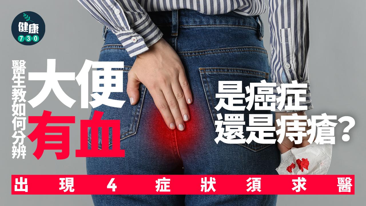 大便 血便 痔瘡 癌症 大腸癌 直腸癌