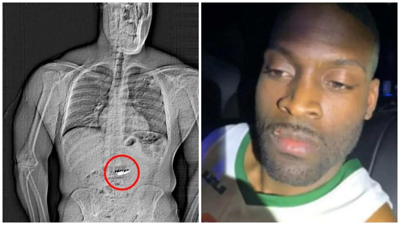 搶劫後遇警截查，男子生吞近600萬元Tiffany耳環。(X)