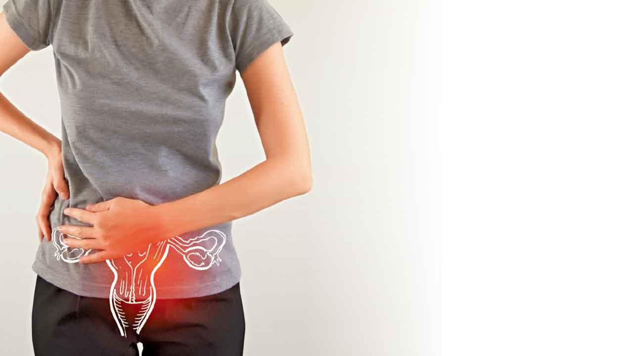 晚期子宮內膜癌 助醫計劃增治療選擇