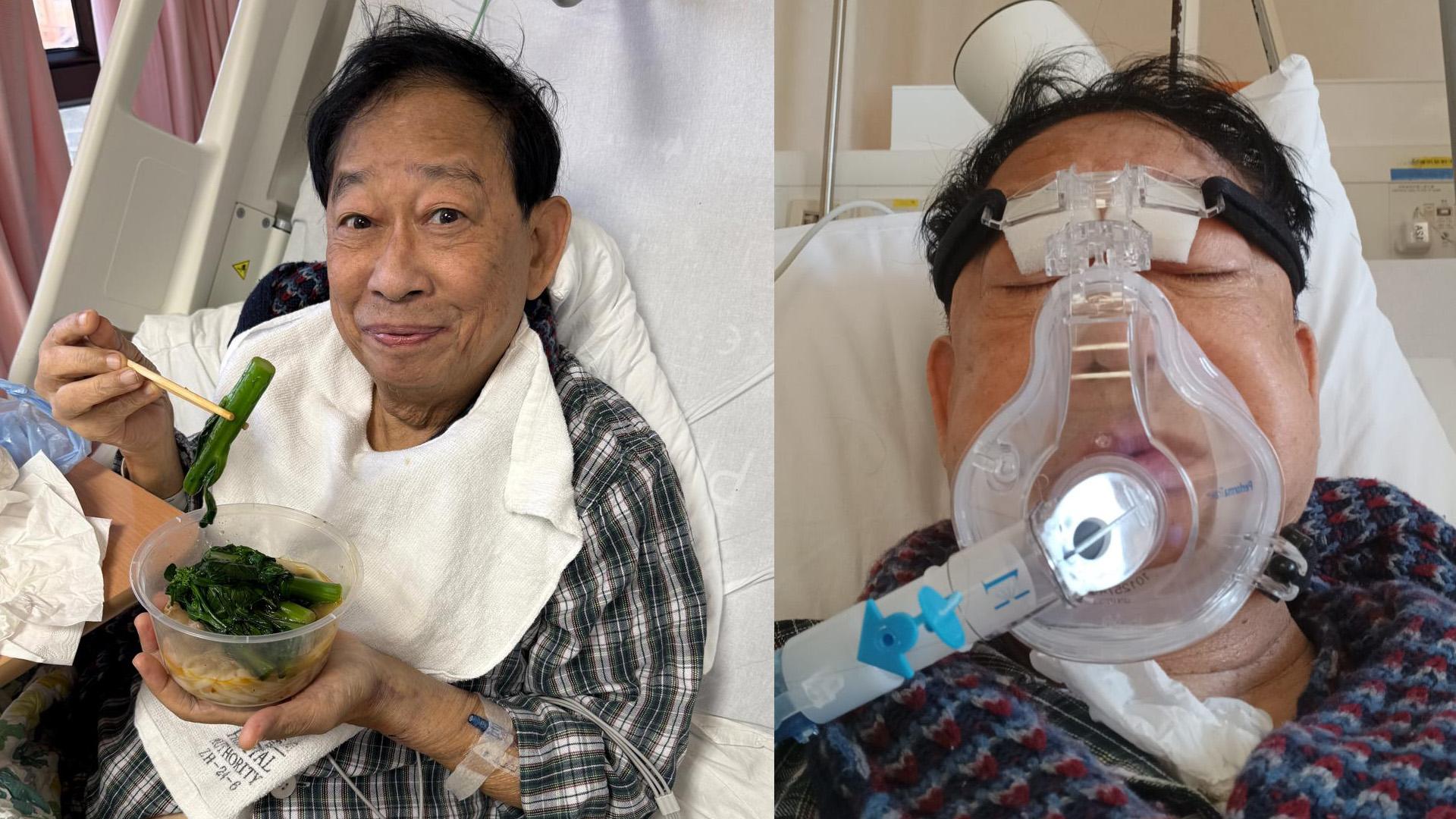 黎彼得流感肺花入ICU 插尿喉要輸兩包血險死