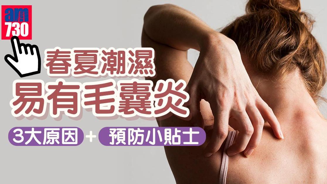 毛囊炎原因｜春夏潮濕易引起 要注重飲食慎選洗衣粉沐浴露（am730製圖）