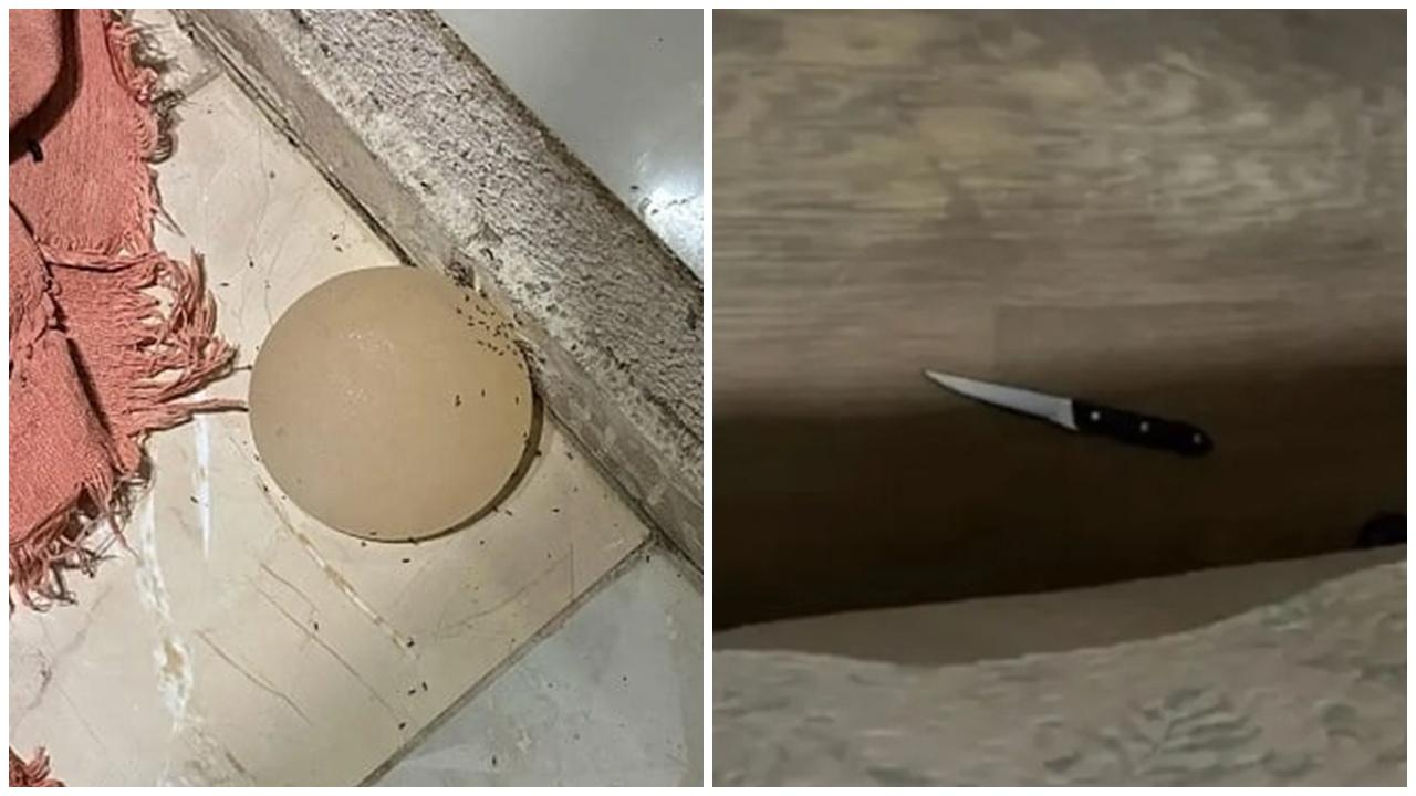 夫妻爭執丈夫監生割妻乳房，取出隆胸植入物丟出窗。(X)